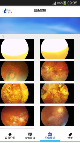 微清醫(yī)療 v1.1 安卓版 0
