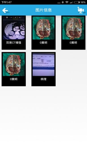 醫(yī)易-病人管理 v1.1 安卓版 1