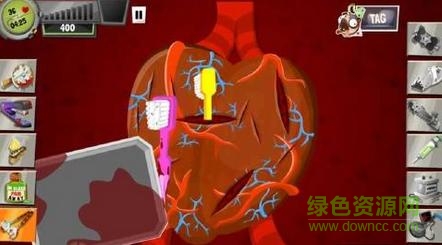 瘋狂外科醫(yī)生3內(nèi)購修改版(surgeon3) v1.43.1 安卓中文版 1