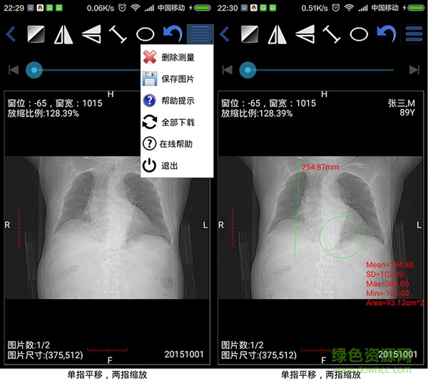 醫(yī)影在線 醫(yī)影在線