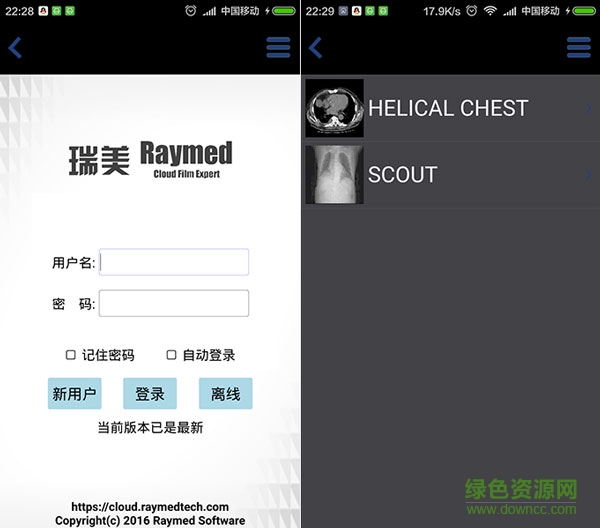 醫(yī)影在線 醫(yī)影在線