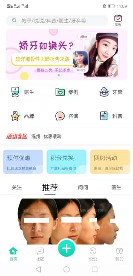 牙套之家官方版3