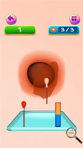 粉刺和黑頭卸妝游戲(Pimples and Blackheads Removal) v1.0.1 安卓漢化版 0