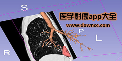 有沒有看影像學(xué)圖的app?好的醫(yī)學(xué)影像app推薦-醫(yī)學(xué)影像的軟件