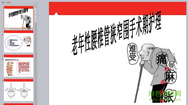 腰椎管狹窄ppt