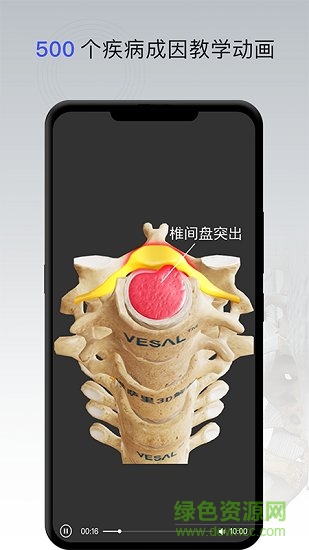 維薩里骨科專家3