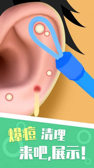 你是來掏耳屎的吧免廣告 v1.1.5 安卓版 2