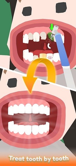 休閑牙醫(yī)(Idle Dentist) v0.0.4 安卓版 3