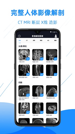 醫(yī)學(xué)影像解剖圖譜 v4.2.0 安卓版 2