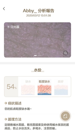 MoreMe水膚鏡官方版 v1.0.30 安卓版 2