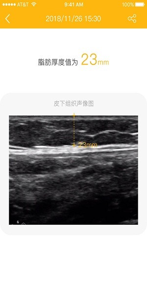 脂肪厚度儀 v2.3.19 安卓版 2