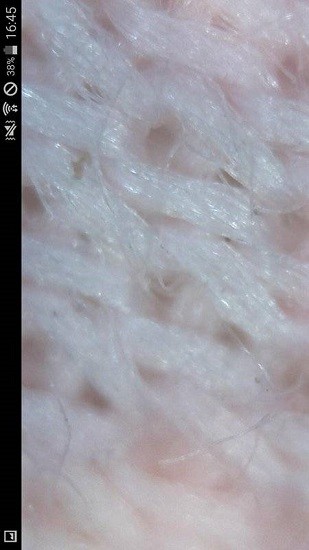 endoscope安卓版