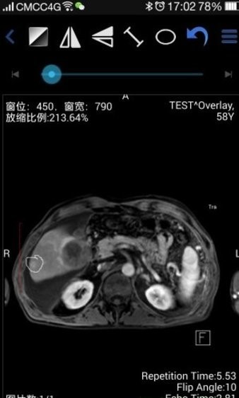 醫(yī)影app(在線醫(yī)學(xué)影像圖庫) v1.0.0 安卓版 0