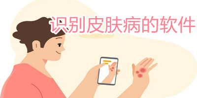 掃一掃識(shí)別皮膚病的app