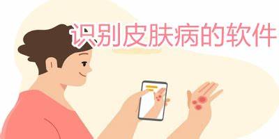 掃一掃圖片識(shí)別皮膚病app