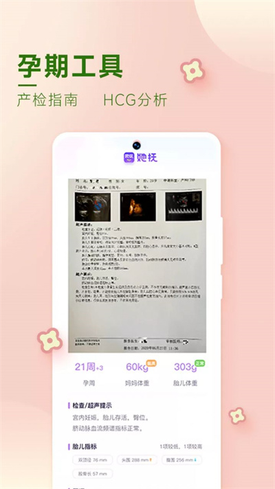 她撫孕育 v2.0.5 安卓版 3