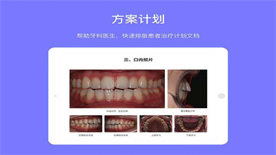 牙E寶 v1.2.0 2