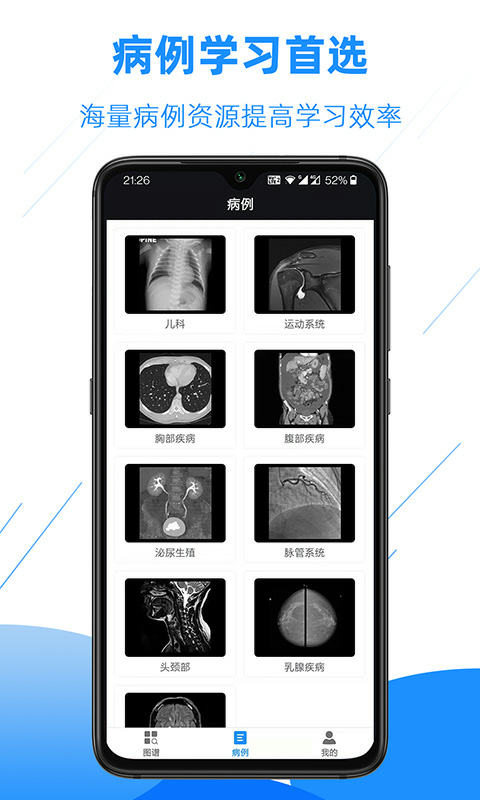 醫(yī)學(xué)影像解剖圖譜 v4.2.0 安卓版 4