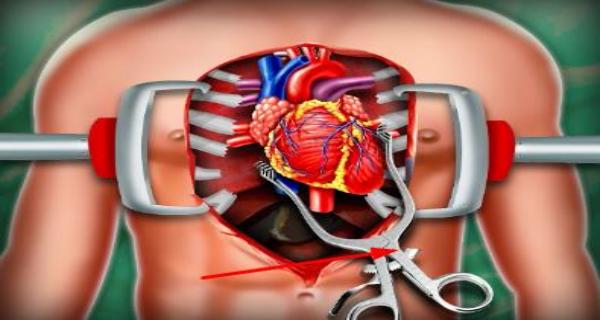 心臟手術(shù)模擬器 v2.4 安卓版 2